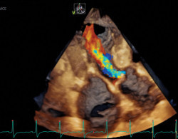 V95-R3_4Vc-Color-Image.jpg