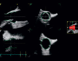 V95-R3_6VT_AutoAVQ_retouch.jpg