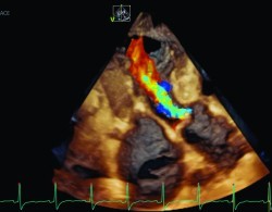V95-R3_4Vc-Color-Image.jpg